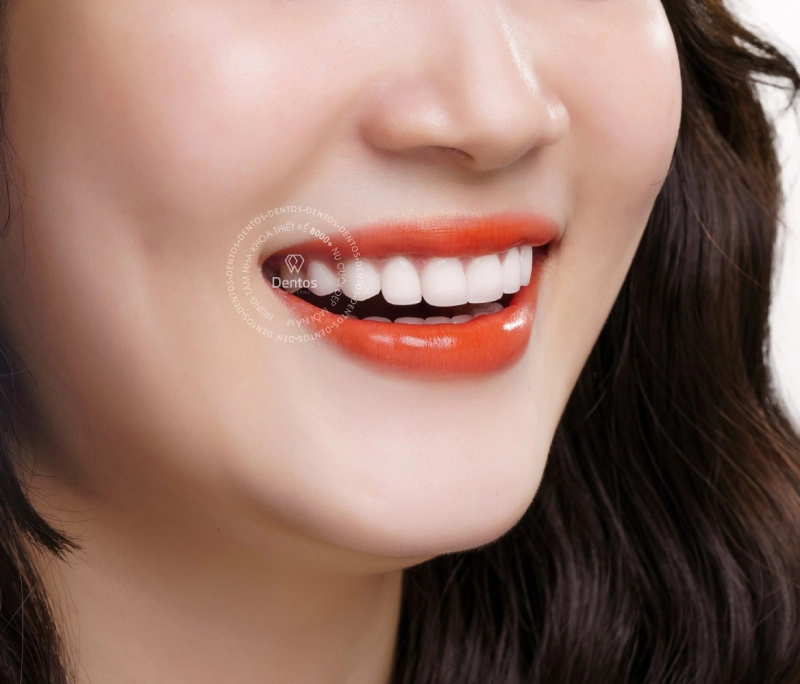 Bọc răng sứ có bền không và tất tật về bọc răng sứ